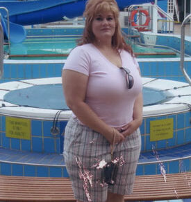 Kym's Story and How the Lap Band Changed Her Life