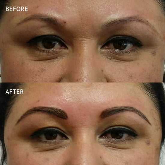 Microblading in Rancho Cucamonga Inland Cosmetic Surgery