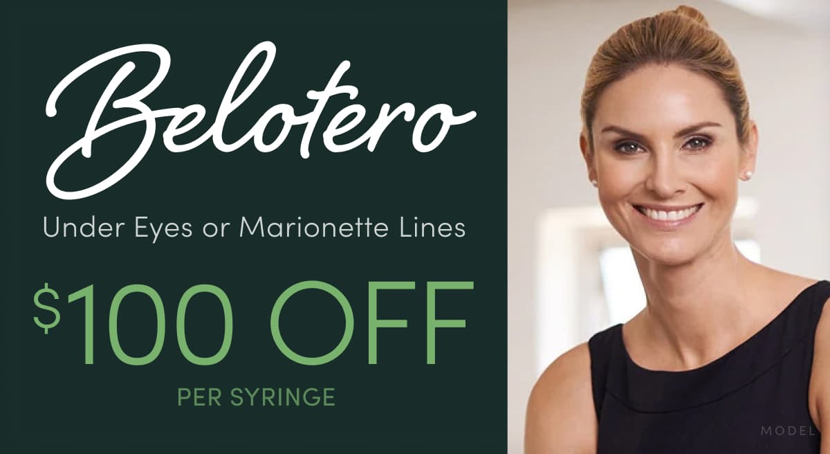 Belotero filler for under-eye hollows or marionette lines