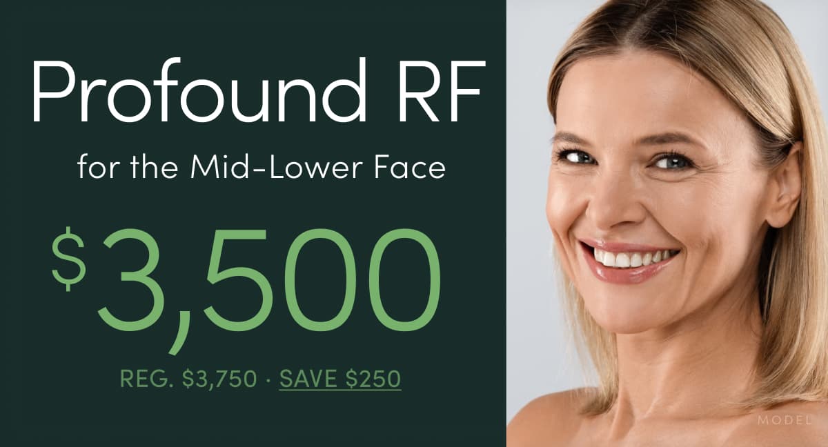 Profound RF radiofrequency microneedling for the mid and lower face