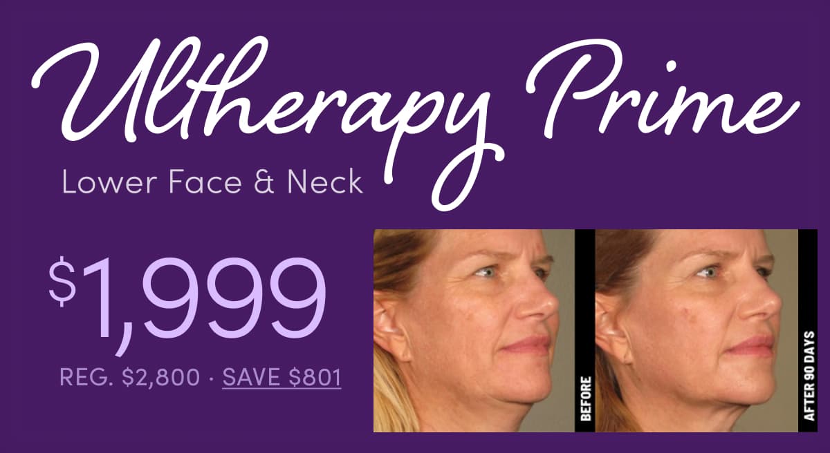 Ultherapy Prime: Lower Face and Neck — non-invasive skin tightening, $1,999 (Reg. $2,800)